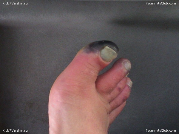 ������� 2005, ���� 79